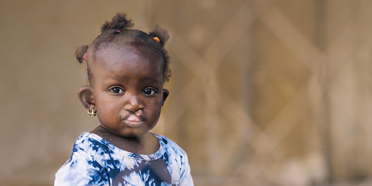 Laissez une empreinte et offrez un avenir aux plus vulnérables atteints dans leur santé et leur dignité.