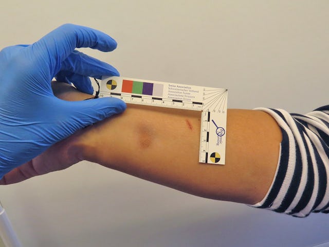 Spuren der Gewalt: Die Studierenden lernen, Verletzungen bis ins kleinste Detail zu untersuchen.